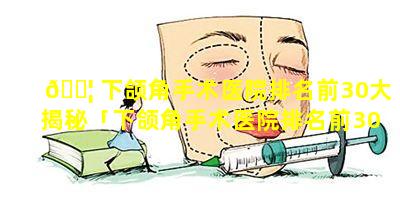 🐦 下颌角手术医院排名前30大揭秘「下颌角手术医院排名前30大揭秘医生」